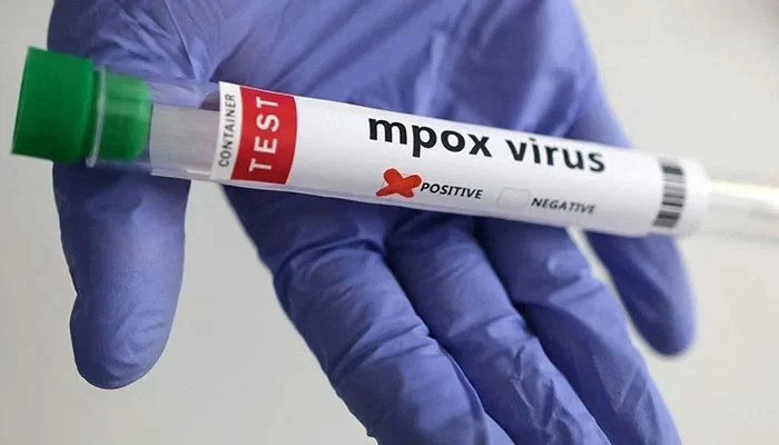 Karachi reports second mpox case in two days, Sindh’s 2026 tally rises to 43